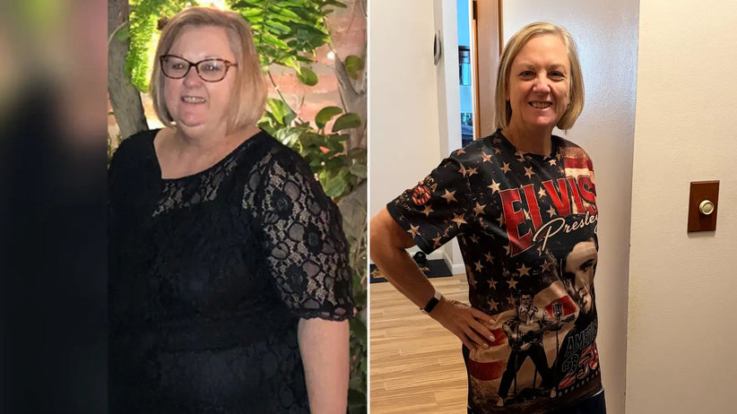 Kathy before and after image