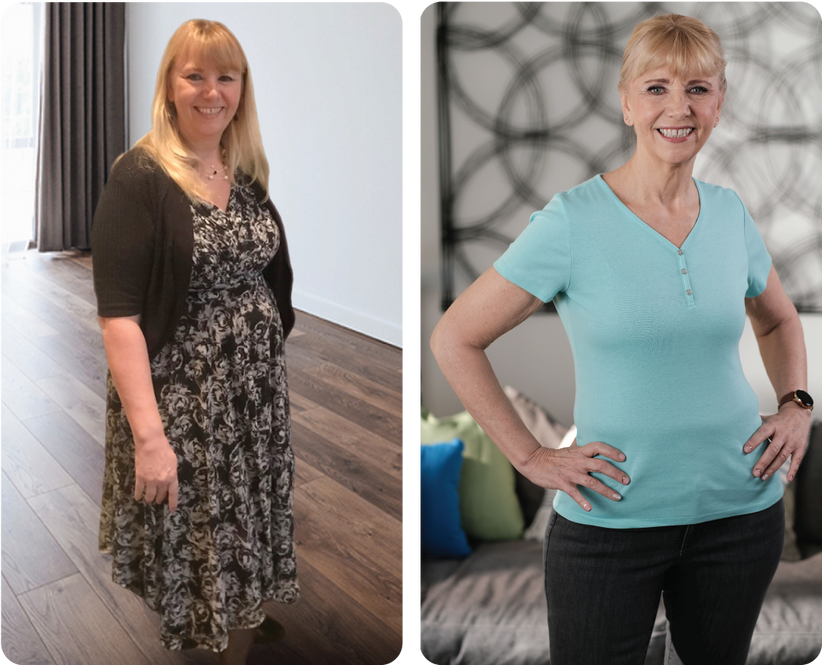 Nancy Before and After Photo