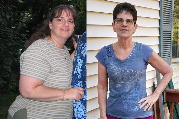 Before and after picture of Barbara