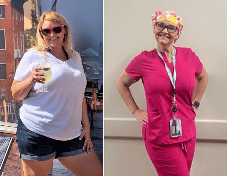 Before and after of Gina. After picture shows Gina smiling in her work scrubs