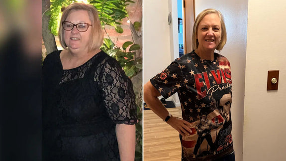 Kathy before and after image