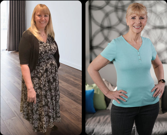 Nancy Before and After Photo