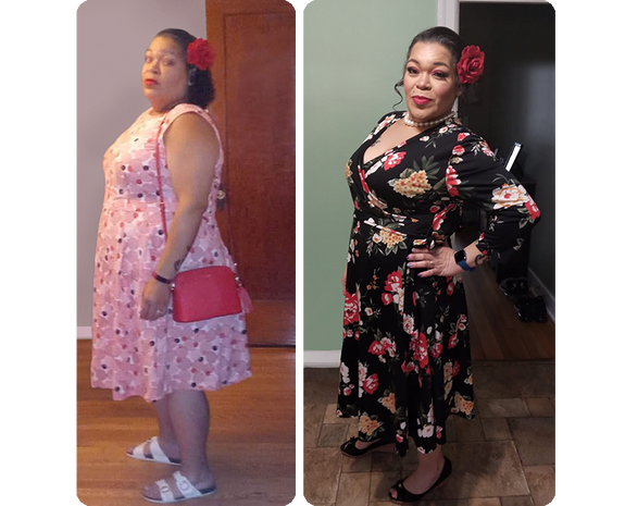 Before and after picture of Araceli St. John