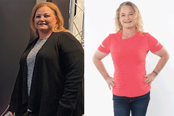 Before and after of Sally 