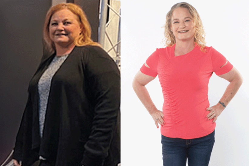 Before and after of Sally 