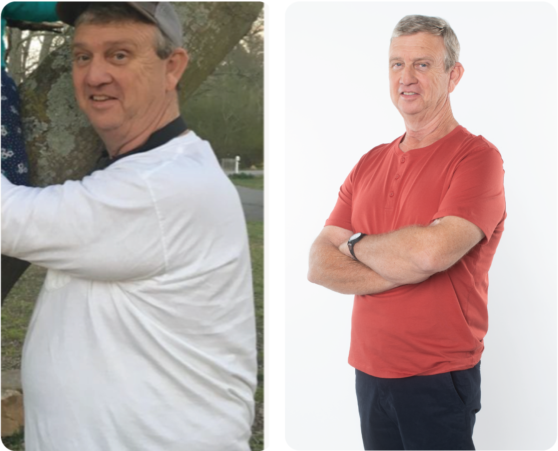 Barry Before and After