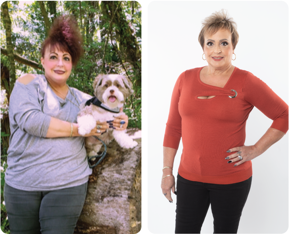 Darlene Before and After
