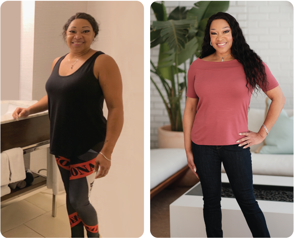Denise Before and After