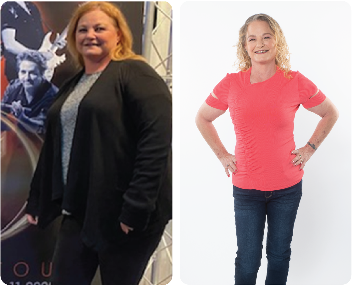 Sally lost 52 lbs. and 11 inches from her waist in 16 months