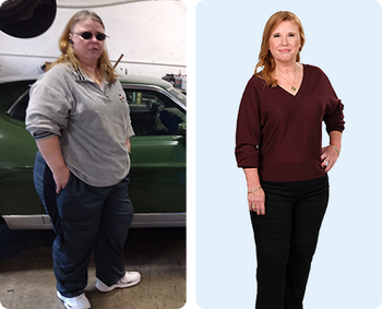 Janice lost 172 lbs. in 27 months and 50% of her body weight